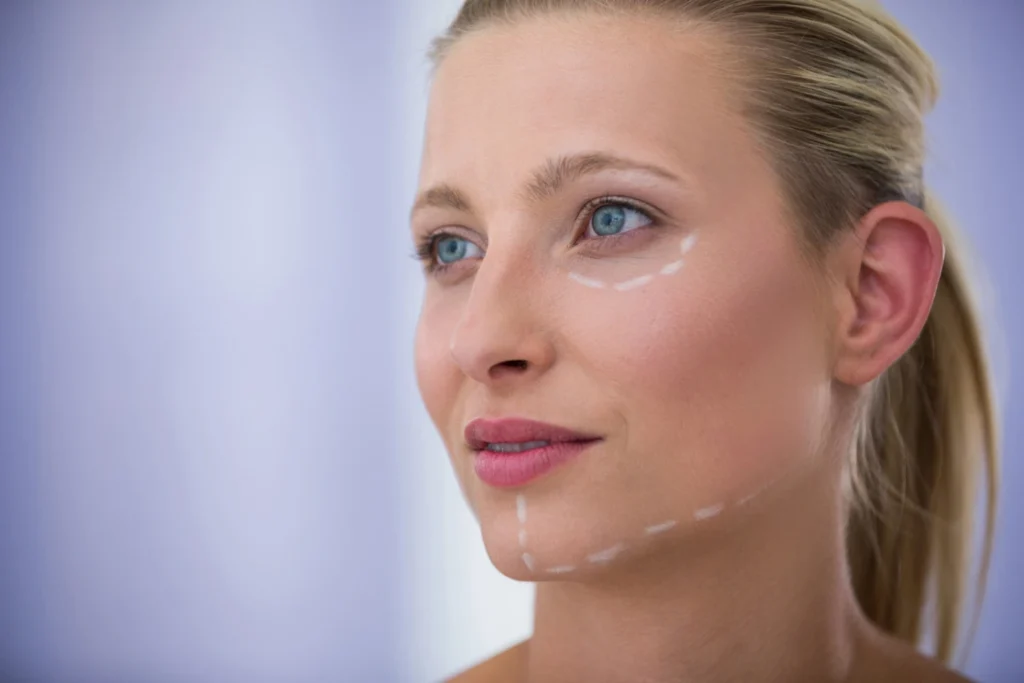 Il viso di una donna con i segni dei trattamenti che il medico estetico gli sta per fare per rassodare la pelle.